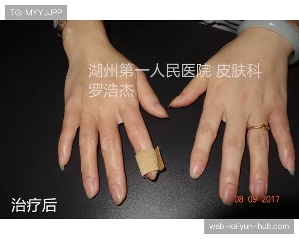 详解篮球规则中手部接触判定的核心依据与执行标准